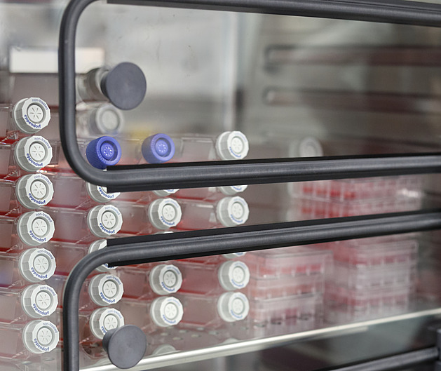 Němce zneklidnil návrat viru dětské obrny. Vystopovali ho v odpadních vodách