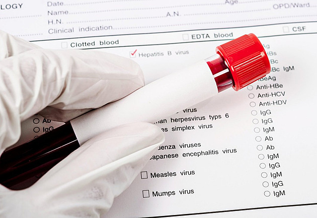 Žloutenka už má na jihu Čech první oběť. Pacienty se daří včas očkovat